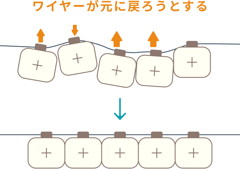 ワイヤーが元に戻ろうとするイメージ